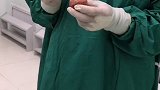 这样的手朮做得人心情都不好了 医学科普 手术