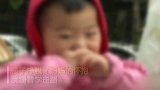 遛狗不栓绳！西安1岁女童遭狗扑咬 被诊断为狂犬病