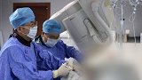 大妈头晕以为中暑 颅内竟有个“马蜂窝” 医生秒变“消防员”