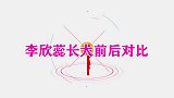 萌娃李欣蕊长大前后对比，短短几年判若两人，病好了长得也漂亮了