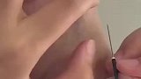 医学生练习扎针，没想手忍不住颤抖