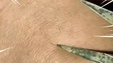 一般人没这个技术帮蚊子修剪指甲