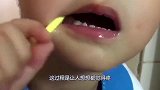 智齿原来是这样拔掉的，3D动画演示过程，网友：看着都疼