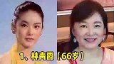 15位不整容的女星今昔对比，美了大半辈子，优雅从容地老去