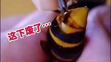 给马蜂拔针，这下手太狠了