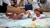 脐带还没脱落的新生儿，被一群实习医生围观，宝宝乖巧配合好可爱