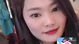 女子拔完智齿后，脸肿成土拨鼠！