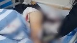 四川42岁男子持刀砍伤女友后自杀 警方通报：情感问题起争执
