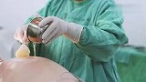 产房直击产妇艰辛的剖腹产分娩经历,看完更懂剖腹产妈妈有多伟大