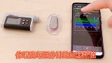 你该了解的胰岛素泵新技术，闭环原理你知道吗？高科技真是好东西