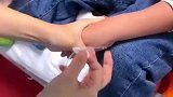 护士给小男孩扎针，针头刚碰到男孩手背他就惊叫出声！