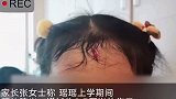 女儿在幼儿园内额头磕出伤口如第三只眼，妈妈列80000余元赔偿单。你们怎么看？幼儿园