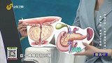 男性防癌 两腺不可忽视