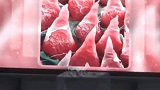 电镜下人体组织