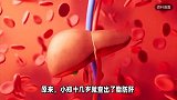 23岁大学生查出早期肝硬化，肝功能10年里多次异常不在乎，医生提醒