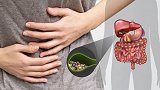 湖北荆州：62岁大妈腹痛难忍 胆囊竟被1012颗结石“盘踞”