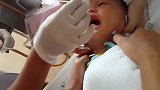宝宝感冒鼻塞太难受，医生治疗方法简单粗暴，宝宝哭的撕心裂肺