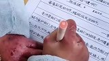 女孩手上长满冻疮让人心疼，孩子依然坚持在学习练字