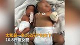 一名262斤产妇 生下10.8斤重巨型婴儿