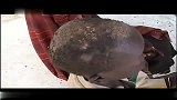 旅游-南苏丹-无国界医生2-20140329