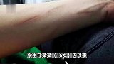 16岁专科学校女生拒去酒吧遭3名室友殴打，警方通报：2人被行拘