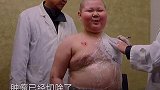 看哭了！你无法想象十多岁的小朋友被骨肿瘤带来痛苦后，还依然热爱生活！️人间世 疾病无情 坚强的孩子