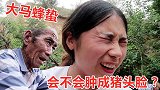 被大马蜂蛰了脸，结果受到弟弟无情嘲笑，会不会肿成猪头脸