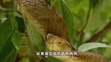 澳大利亚发现世界首例蛇蛔虫感染者：脑中取出8厘米活体蛔虫
