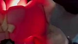 显脉仪照不到小孩的血管，护士只能靠手指摸索