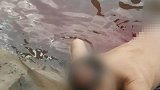 男子江中游泳臀部被快艇划开大口 忍痛游上岸