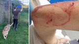 南非：一名动物管理员被猎豹袭击，胳膊被咬出4个洞