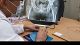 髋痛等于股骨头坏死吗？不一定！小心撞击症医学科普 骨科 医者仁心