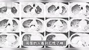 惊呆！杭州男子冬天确诊“热射病”，两肺全白了！曾去过这地方