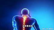 有些人活着，可屁股“死”了！26岁女孩加班久坐患上死臀综合征