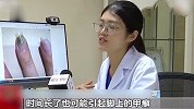 女子做完美甲后指甲长霉菌，有人甚至因美甲感染HPV病毒，部分美甲店卫生堪忧