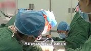 23岁女子腹胀如鼓取出42斤肿瘤：为姐妹瘤，大肿瘤直径45厘米