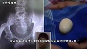 14岁少年连续产下20枚鸡蛋，医生给出答案，父亲拒绝相信