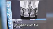 幼师摁小孩头撞向课桌致牙齿断裂，事后自称心情不好，官方通报