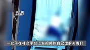 女子曝前夫冒充外卖员进房毒打自己：扇耳光捶击身体，且不止一次