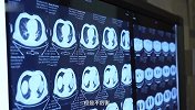 目前医院情况如何？直击急诊与重症一线