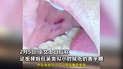 摔炮包装像糖果，女子误食炸伤口腔：当时嘴是麻木的，都是火药味