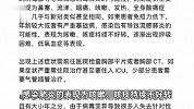 甲流也可能引起白肺？医生：基础病患者需警惕