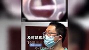 女子酒后催吐，不慎将19厘米长牙刷掉入胃中，医生：还好来得及时