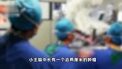 27岁小伙胡子变少胸部变大、对异性失去兴趣……出现这些症状要警惕