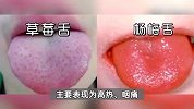 确诊超2000例！有娃刚开学就被放假10天，暂无疫苗可预防