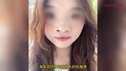 先天性唇腭裂女大学生哭诉遭恶评：因妈妈吃药导致完全无鼻骨