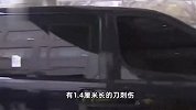 首尔大学医疗小组：李在明左侧颈内静脉60%被切断 术后状态“还有待观察”
