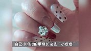 女子美甲后感染HPV病毒，指缝间长出菜花！医生提醒：这类人别做