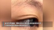 黑眼圈无法彻底根除？贵妇眼霜是“智商税”吗？