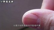 指甲上有竖纹，是身体出问题了吗？医生提醒：要当心了